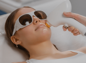 laser hair removal