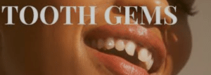 tooth gems