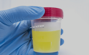 cloudy urine